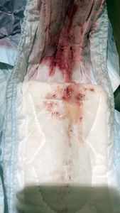 Menstruation vol. 81 37ownvli2g