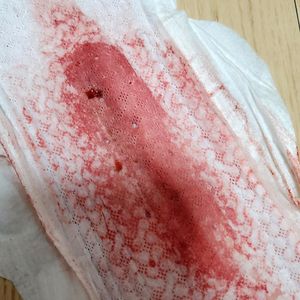 Menstruation vol. 81 n7ownwsgpp