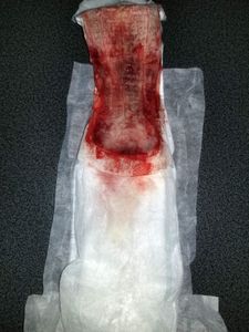 Menstruation vol. 81 z7ownwtrus