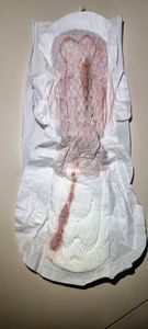 Menstruation vol. 81 h7ownx03yz