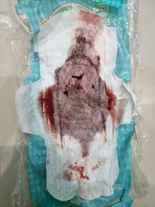 Menstruation vol. 81 d7ownxk0gu