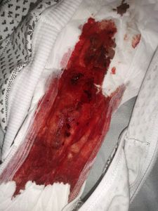 Menstruation vol. 81 77owoaehti