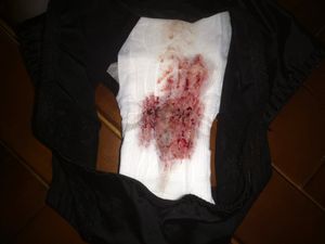 Menstruation vol. 81 z7owoapa5t