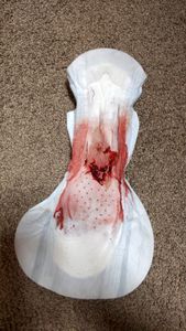 Menstruation vol. 81 x7owoascai