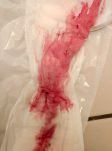Menstruation vol. 81 27owocezxz