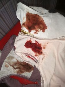 Menstruation vol. 81 o7owod2zht