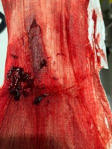 Menstruation vol. 81 f7owodjmeg