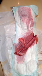 Menstruation vol. 81 d7owodqvxa