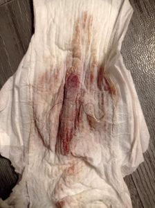 Menstruation vol. 81 c7owoexxye