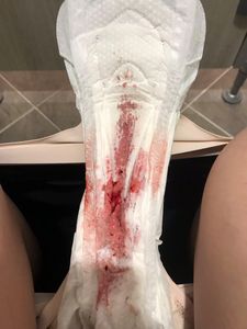 Menstruation vol. 81 f7owoh1fa2