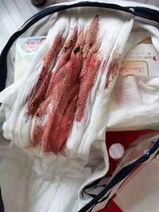 Menstruation vol. 81 57owohllvb
