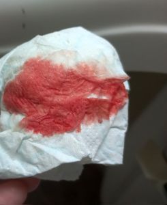 Menstruation vol. 81 d7owohnyti