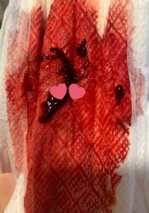 Menstruation vol. 81 77owo040qm