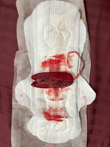 Menstruation vol. 81 r7owo1bzmk